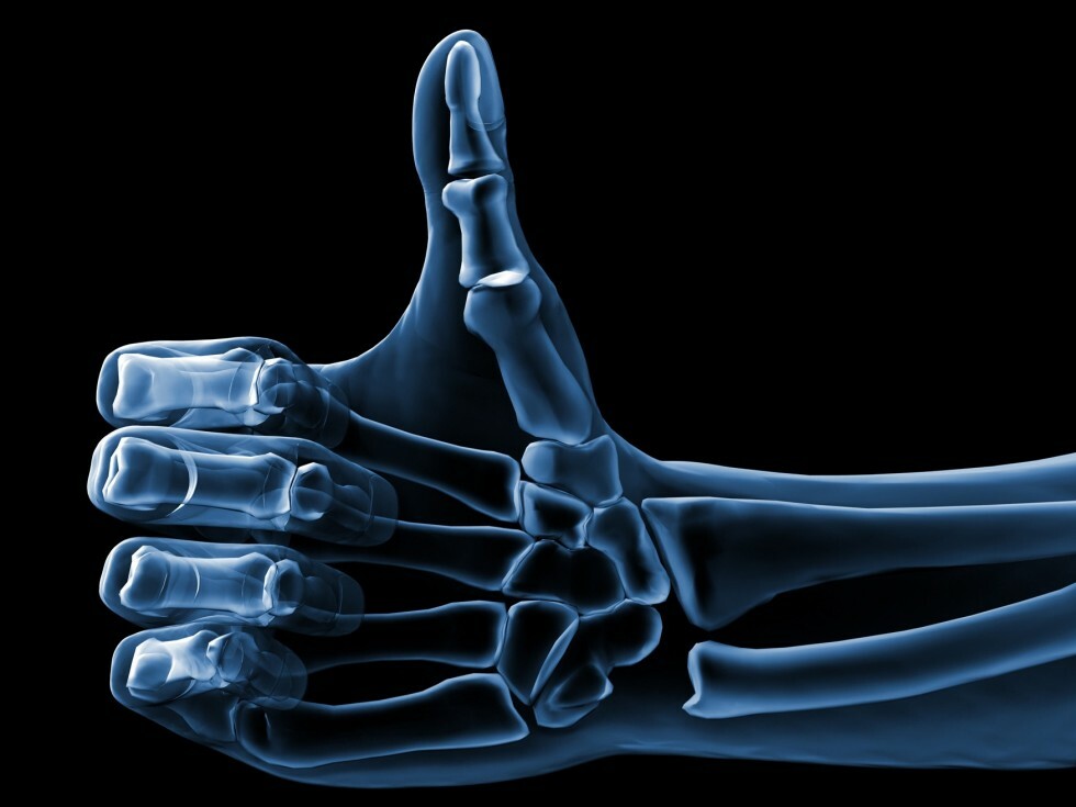 x-ray of hand giving thumb up